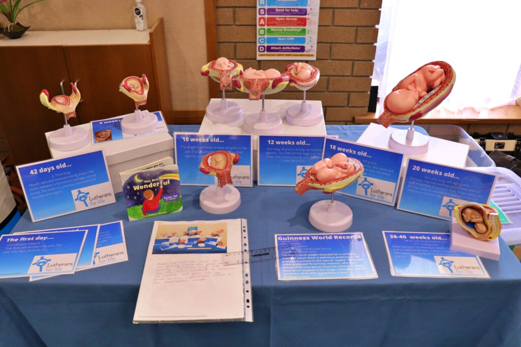 Foetal model